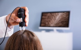Analisi dei capelli e del cuoio capelluto 
