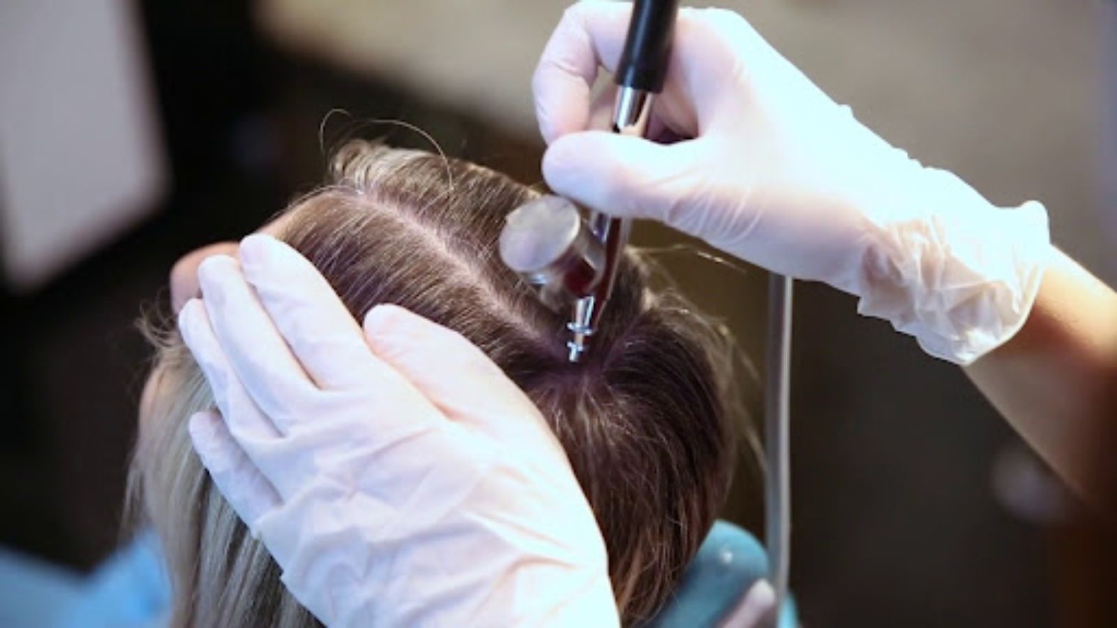 Ossigenoterapia capelli 