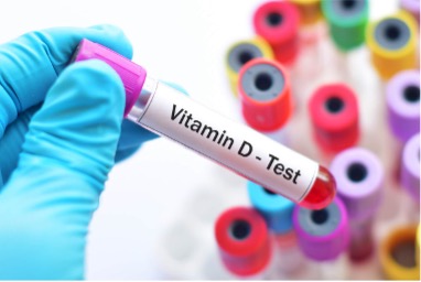 Test della vitamina D 